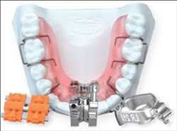 Global Orthodontic Supplies Sales volume