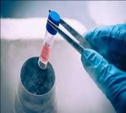 Global Stem Cell Therapy Market size