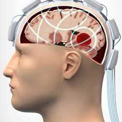 Global Stroke Diagnostics And Therapeutics SWOT analysis of the market