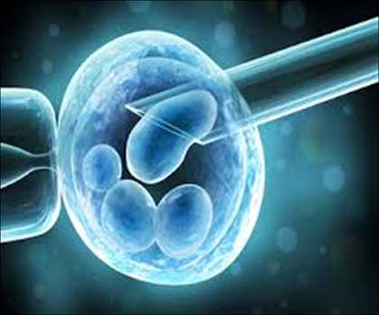 체외수정(IVF) 시장