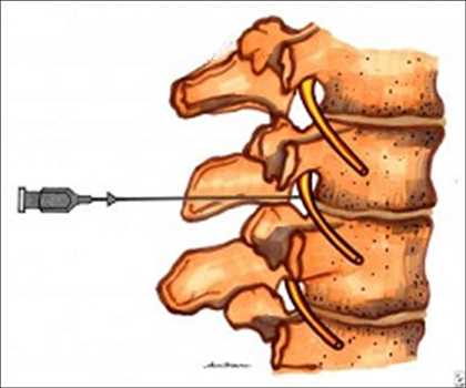 Pain Management Therapeutics Market