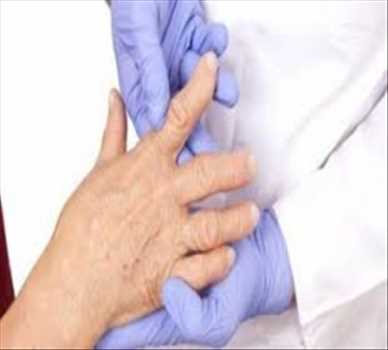 Rheumatoid Arthritis Drugs Market