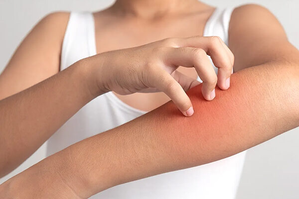 pruritus therapeutics