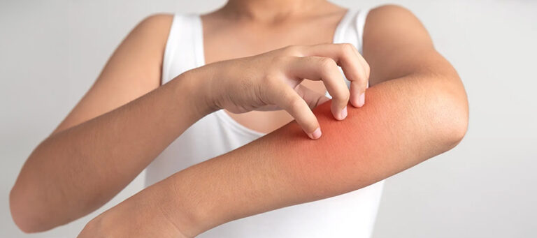 pruritus therapeutics